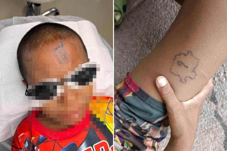 10-Year-Old Boy Humiliated After Bullies Tattoo Vulgar Word on His Forehead
