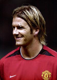 David Beckham of Manchester United, smiling despite a cut above his eye.