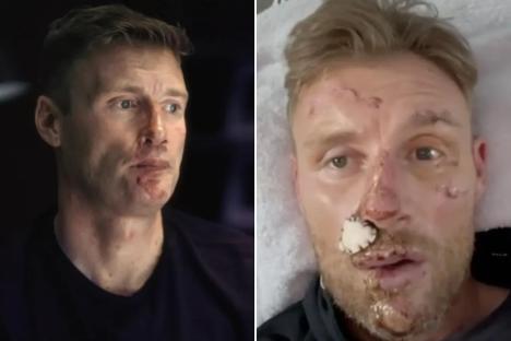 Freddie Flintoff reveals ‘I wished I’d been killed’ in horrifying Top Gear smash saying ‘I didn’t think I’d make it