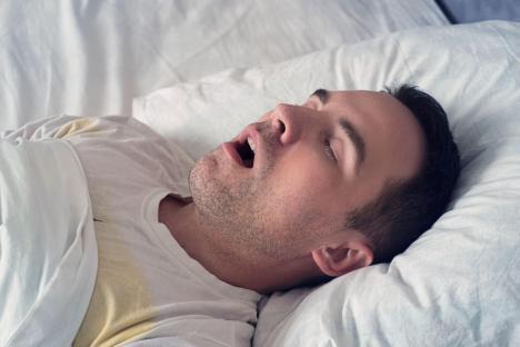 This is a photo a young man snoring while sleeping on his back. See PA Feature HEALTH Sleep. WARNING: This picture must only be used to accompany PA feature HEALTH Sleep. PA Photo. Picture credit should read: Alamy/PA. NOTE TO EDITORS: This picture must only be used to accompany HEALTH Sleep.