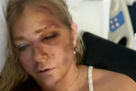 Andrew & Epstein accuser Virginia Giuffre’s dad is ‘praying’ for daughter after bus crash leaves her with ‘days to live’
