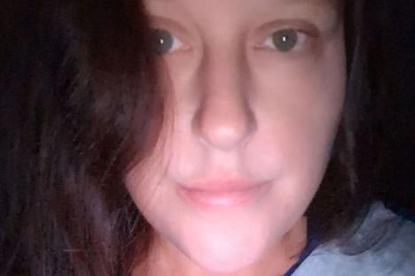 Mum, 42, left fighting for her life in septic shock and has foot amputated after spotting an ingrown nail