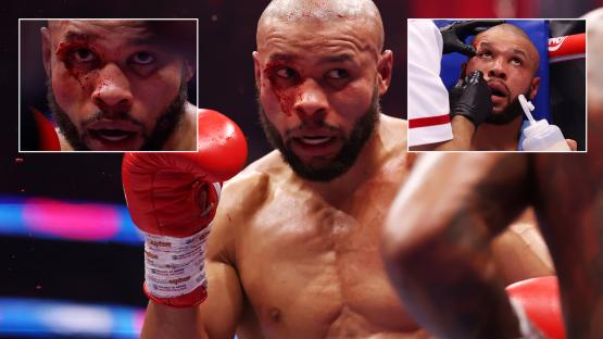 Chris Eubank Jr taken to hospital with horror eye cut and swollen face after brutal win over Conor Benn
