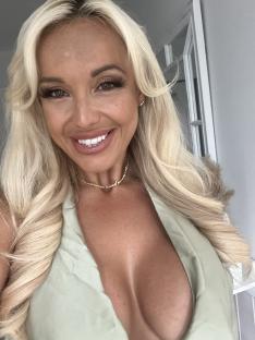 Close-up of Jen Atkin, former Miss Great Britain, showing forehead scarring.