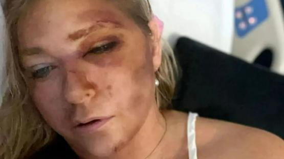 Driver of Virginia Giuffre’s car in mysterious bus crash breaks silence…urging Andrew accuser to ‘clear everything up’