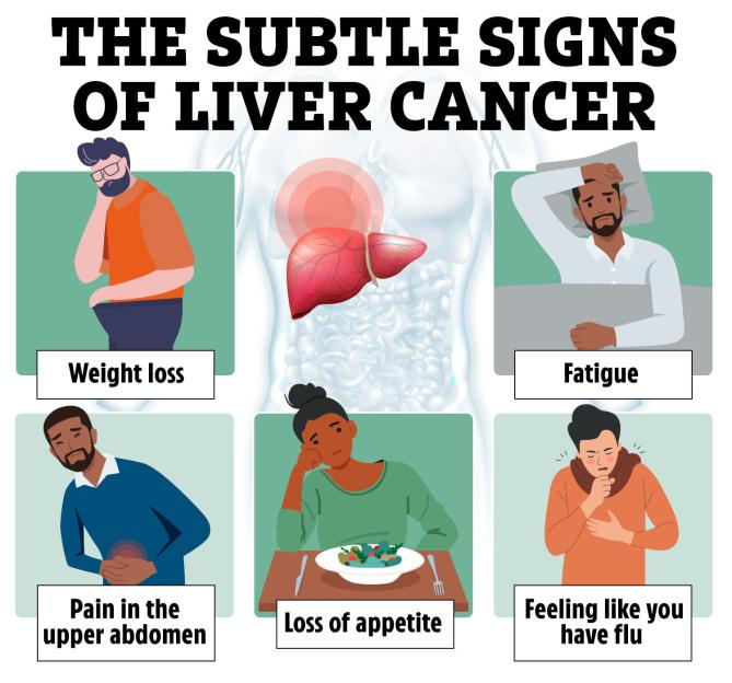 Illustration of the subtle signs of liver cancer including weight loss, fatigue, pain in the upper abdomen, loss of appetite, and feeling like you have flu.