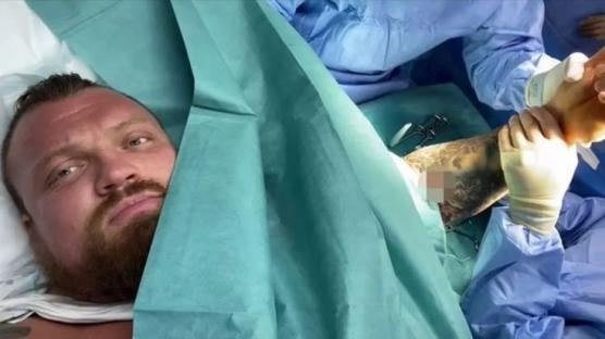 Eddie Hall in surgery.