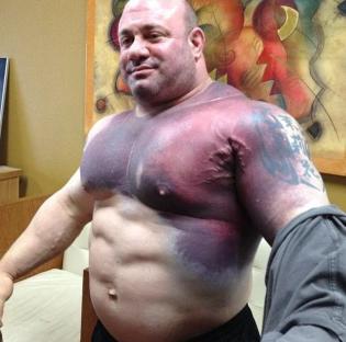 Muscular man with large bruise on his chest.