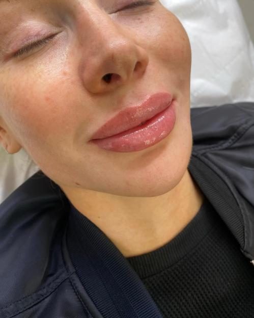 Olivia Attwood getting a lip blush tattoo.