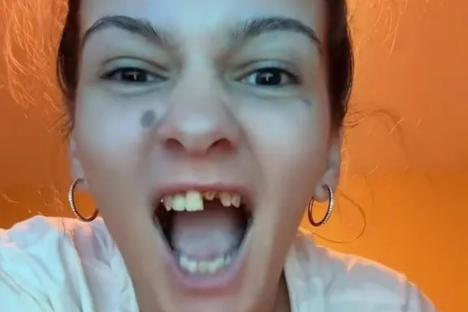 I flew to Colombia & splashed £6k on veneers – trolls say they look ‘too white’ but it was painless & change my life