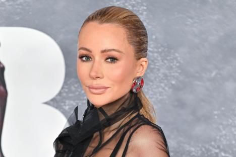 From ‘grotesque’ lips to £3K ‘watermelon’ boobs that cost £10K to fix – Olivia Attwood reveals what she spent on surgery