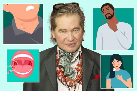 A cough that won’t budge and 10 other easy-to-miss signs of throat cancer after Val Kilmer’s battle with the disease