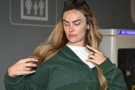 MAFS UK’s Amy pictured bloodied and bandaged after secret face op – revealing trolls left her desperate for surgery