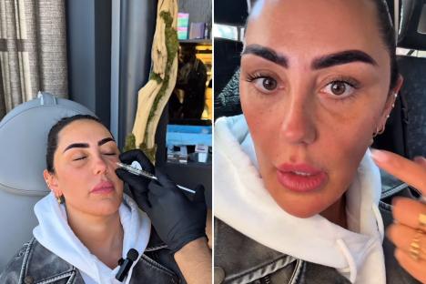 Geordie Shore’s Sophie Kasaei reveals her new look face after getting her filler dissolved