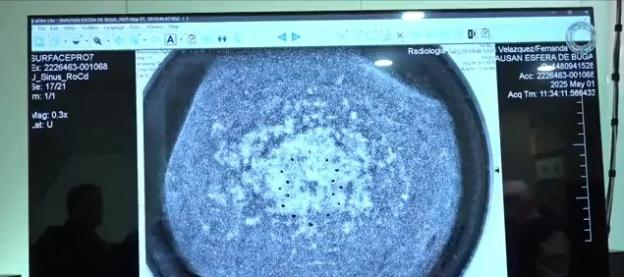 X-ray image of a UFO sphere that crash-landed in Buga, Colombia.