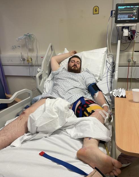 A bearded man in a hospital gown lying in a hospital bed with his left leg elevated, a blood pressure cuff on his left arm, and medical monitoring equipment beside him.