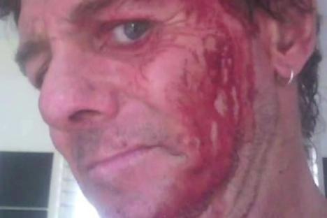 I was beaten up by 6ft kangaroo – beast grabbed me in vice-like headlock & clawed my stomach before a miracle escape