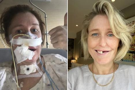 Cancer stole HALF my smile – I can feel hairs growing inside my mouth after my leg and foot were used to rebuild my face