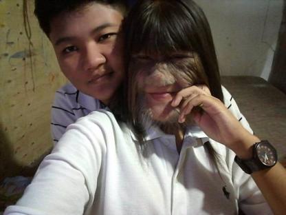 Selfie of a young couple; the woman has Ambras syndrome.