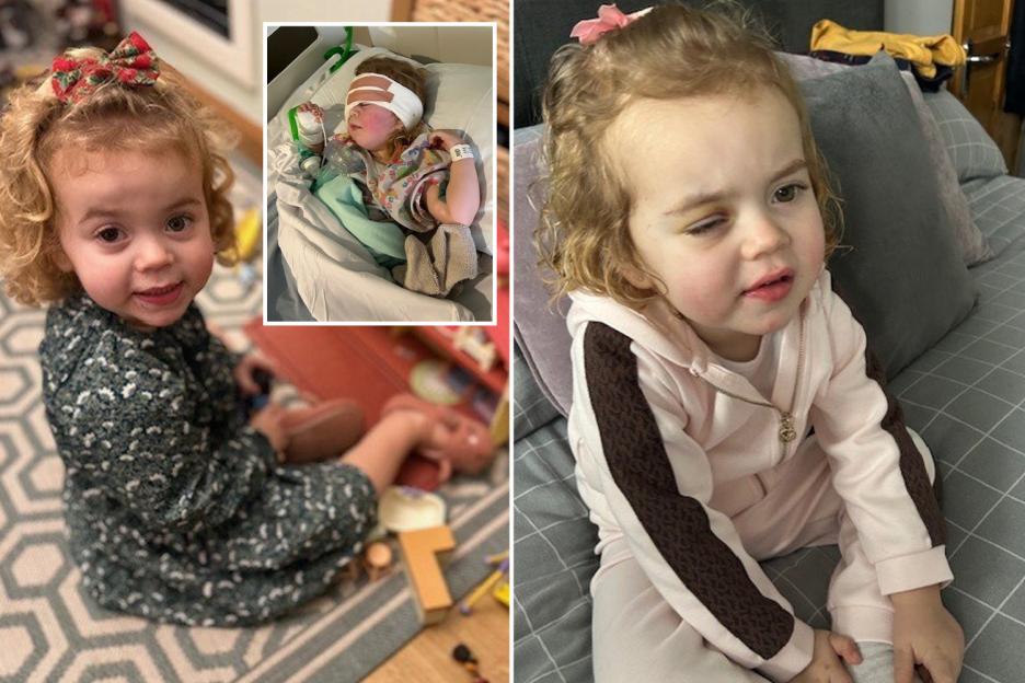 Our baby girl Jessy, 4, complained of a sore eye – we were shocked when docs said she needed it removed urgently