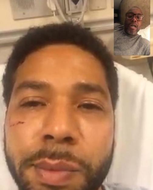 Jussie Smollett in a hospital bed, video chatting.