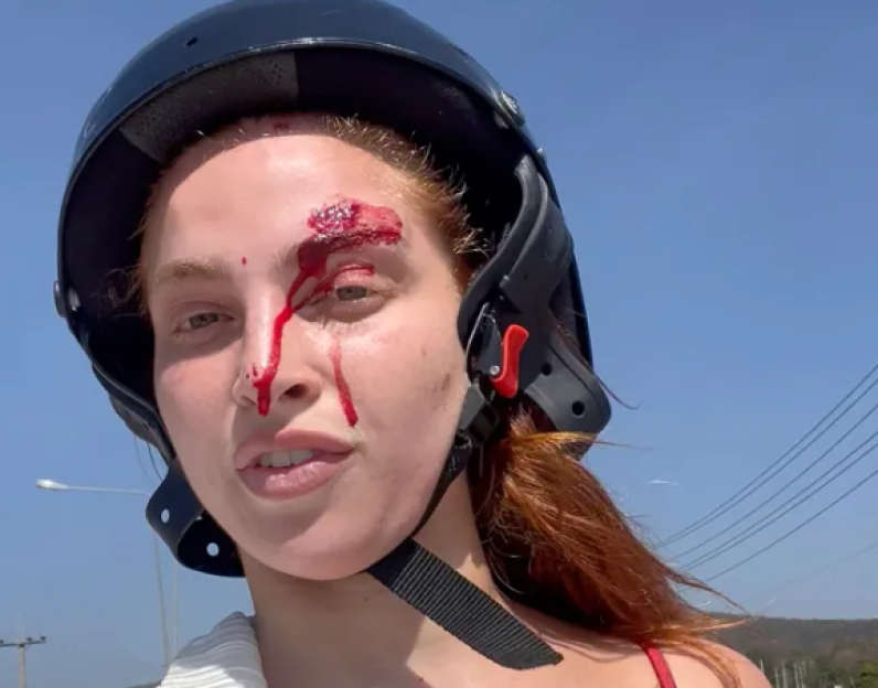 Love Island star, 24, in horror motorbike crash in Thailand leaving her with bloody wounds and ‘skin stripped off’