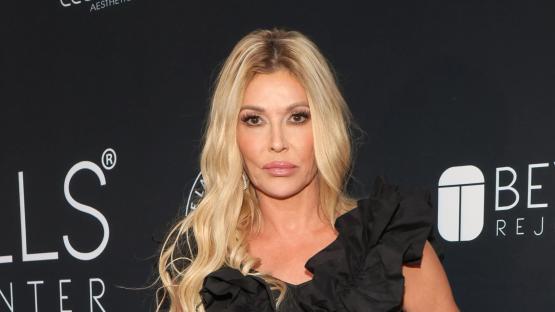 I was a glam TV star but now aged 52, my face is collapsing and there’s something MOVING under my skin – docs won’t help