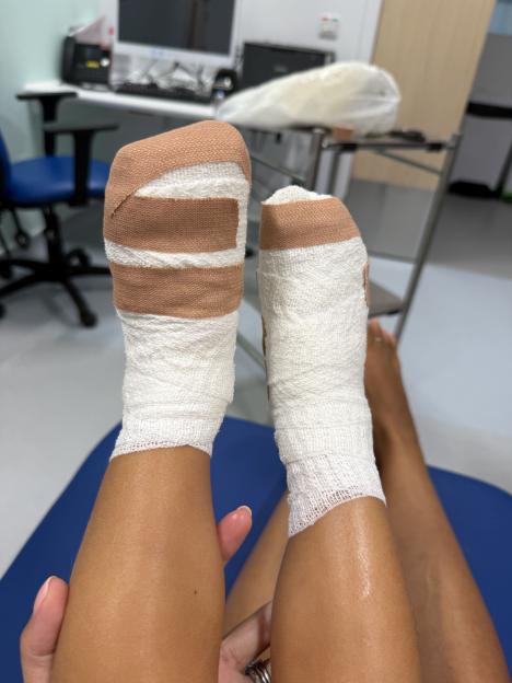Bandaged toddler's feet in a hospital.