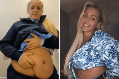 I ignored warnings and had a mummy makeover in Turkey – it’s the best £5,000 I’ve ever spent