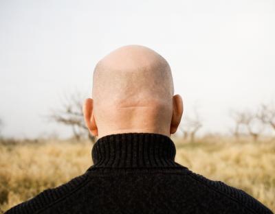 Eight horrifying side-effects of tablets to reverse male baldness ‘revealed’ by nation’s drug watchdog