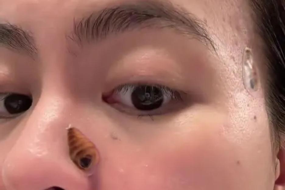 I thought my new pimple patches were cute but instead I look like I’m covered in flesh-eating bacteria
