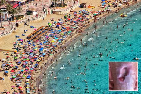 Woman’s leg left rotting with infection after swimming in the sea in holiday hotspot