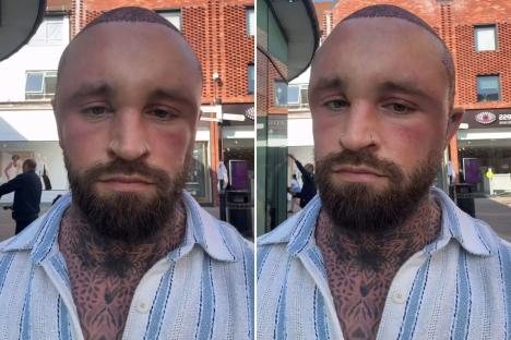 MAFS star sparks concern with extremely swollen head in dramatic pics after surgery – can you tell who it is?