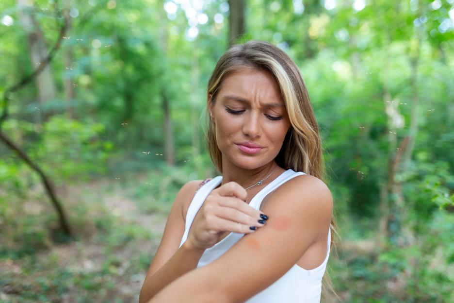 Itchy insect bite - Irritated young female scratching her itching arm from a mosquito bite at the park during summertime.