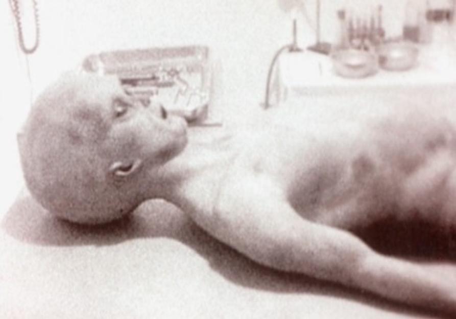 Collage of alleged Roswell alien autopsy stills.