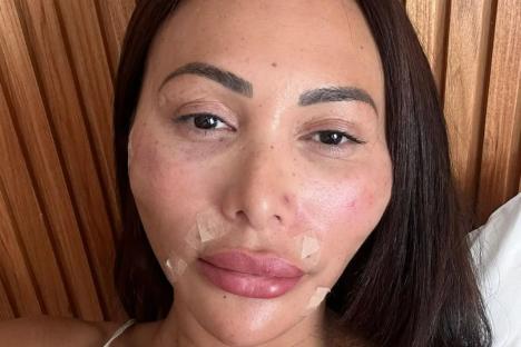 I spent £75k to turn myself into a ‘yummy mummy’ – not only am I now more confident in a bikini, but a better parent too