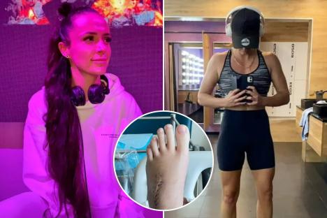 I had memory loss, fatigue and seizures – it turned out to be a SPLINTER lodged in my foot five years ago