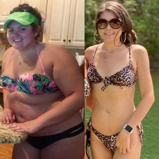 Before and after photos of a woman's weight loss.