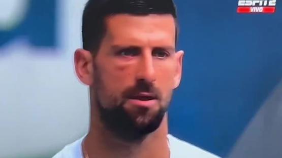 ‘What happened to his eye?’ – Tennis fans concerned for Novak Djokovic after seeing swollen face before Miami Open final