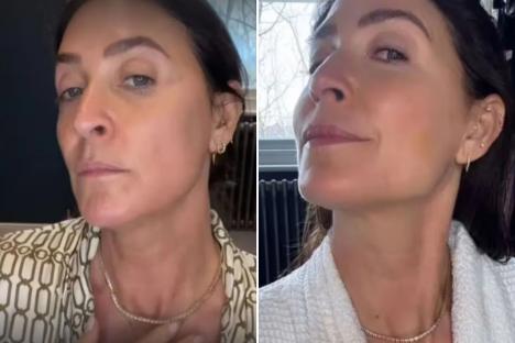 The celeb-approved buy that’s a ‘game changer’ for saggy necks – Lisa Snowdon’s a fan & you’ll notice results in 7 days 