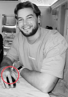 Black and white photo of Chris wearing a ring.