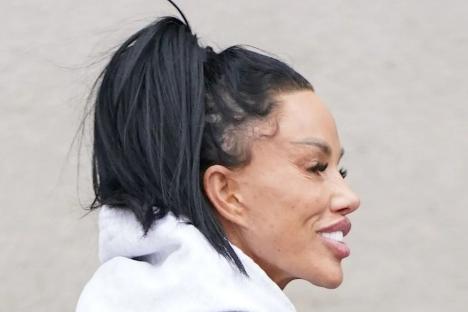 Katie Price’s £10k facelift looks uncomfortably tight as she grins outside panto job