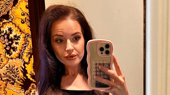 I’ve lost 115lb on Mounjaro – yes I have loose skin but my hubby doesn’t mind, and we can finally try for our dream baby