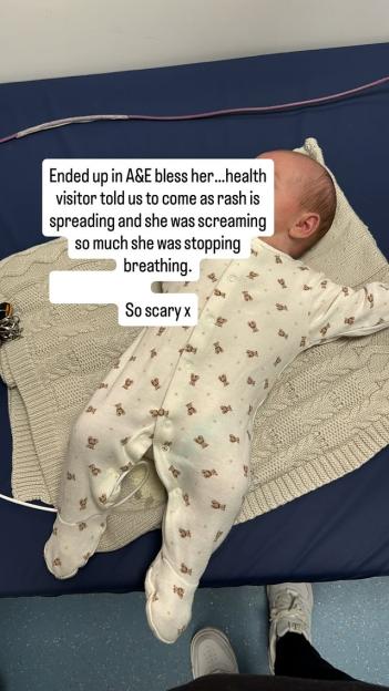Infant in hospital with rash and breathing difficulties.